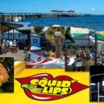 Squid Lips Coupons Gallery Image